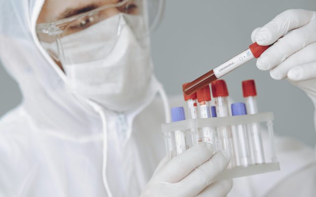 coronavirus-covid-test
