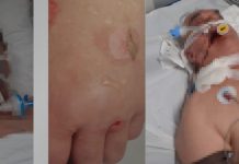 Sporuri uriașe, dar pacienții Covid 19 sedați și legați de pat. Declaraţiile unui cadru medical de la Spitalul Judeţean Sibiu