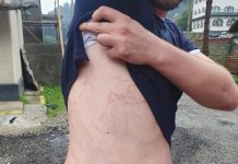 Bărbat surprins de furtună în Munții Făgăraș. Fulgerul a lovit aproape de el și a rămas inconștient