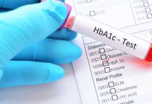 Analizele de hemoglobină glicozilată sunt decontate de către CAS Brașov. La ce laboratoare se pot face programări