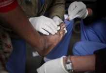 Asta mai lipsea. Două cazuri de lepră confirmate la Cluj. Pacientele sunt originare din Asia, imigranți, și lucrau la un salon SPA