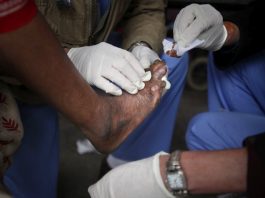 Asta mai lipsea. Două cazuri de lepră confirmate la Cluj. Pacientele sunt originare din Asia, imigranți, și lucrau la un salon SPA