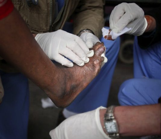 Asta mai lipsea. Două cazuri de lepră confirmate la Cluj. Pacientele sunt originare din Asia, imigranți, și lucrau la un salon SPA